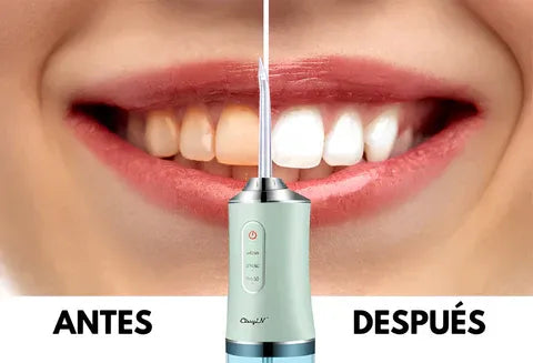 ✨ ¡Super Oferta 2025! Irrigador Dental Pro | Elimina el Mal Aliento y la Placa